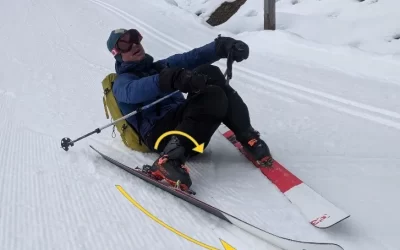 When Things Go Valgus